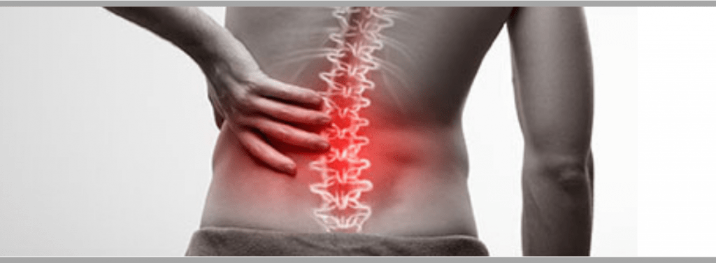 Top Four Misconceptions about Back Pain Image