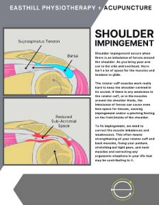 Shoulder-Impingement